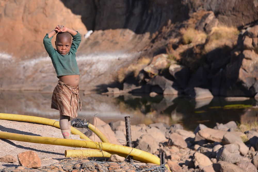 Semonkong Hospital Project